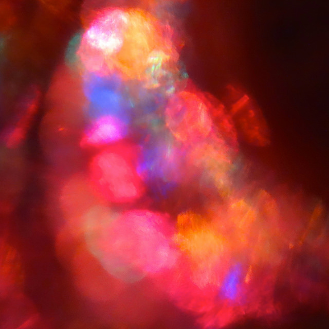 This photo shows a cardiogram